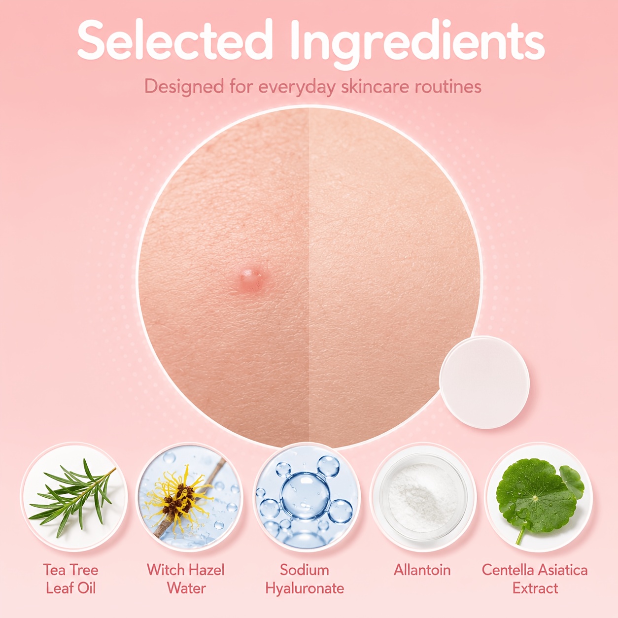 240/480/720 шт. гидроколлоидны – обзор и цена Hydrocolloid Acne Patch