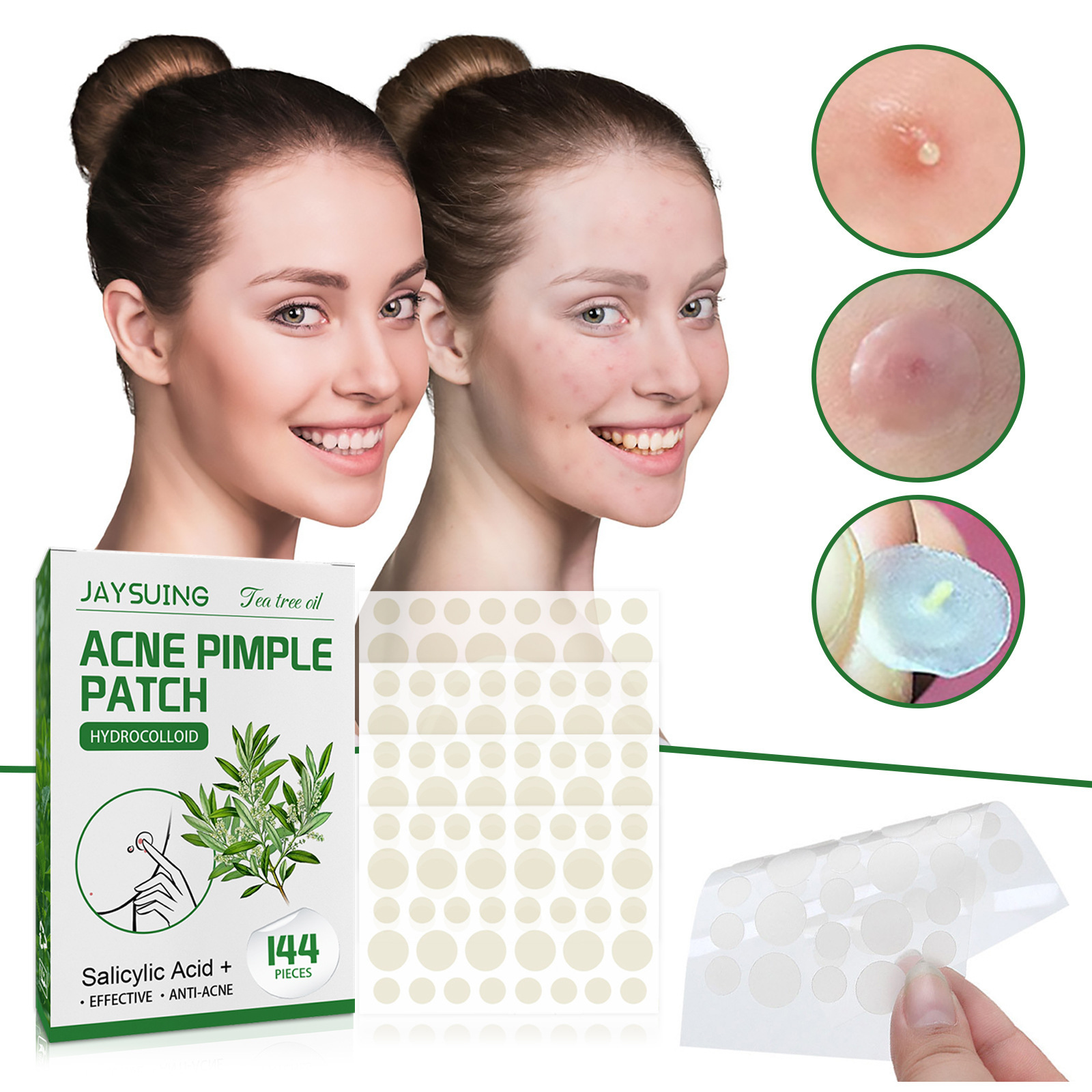Гидроколлоидные пластыри от пр – обзор и цена Hydrocolloid Acne Patch
